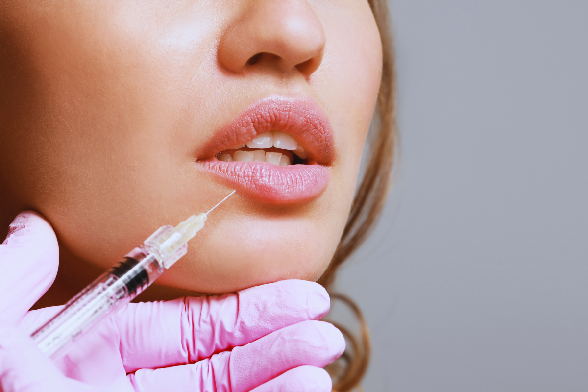 lip filler