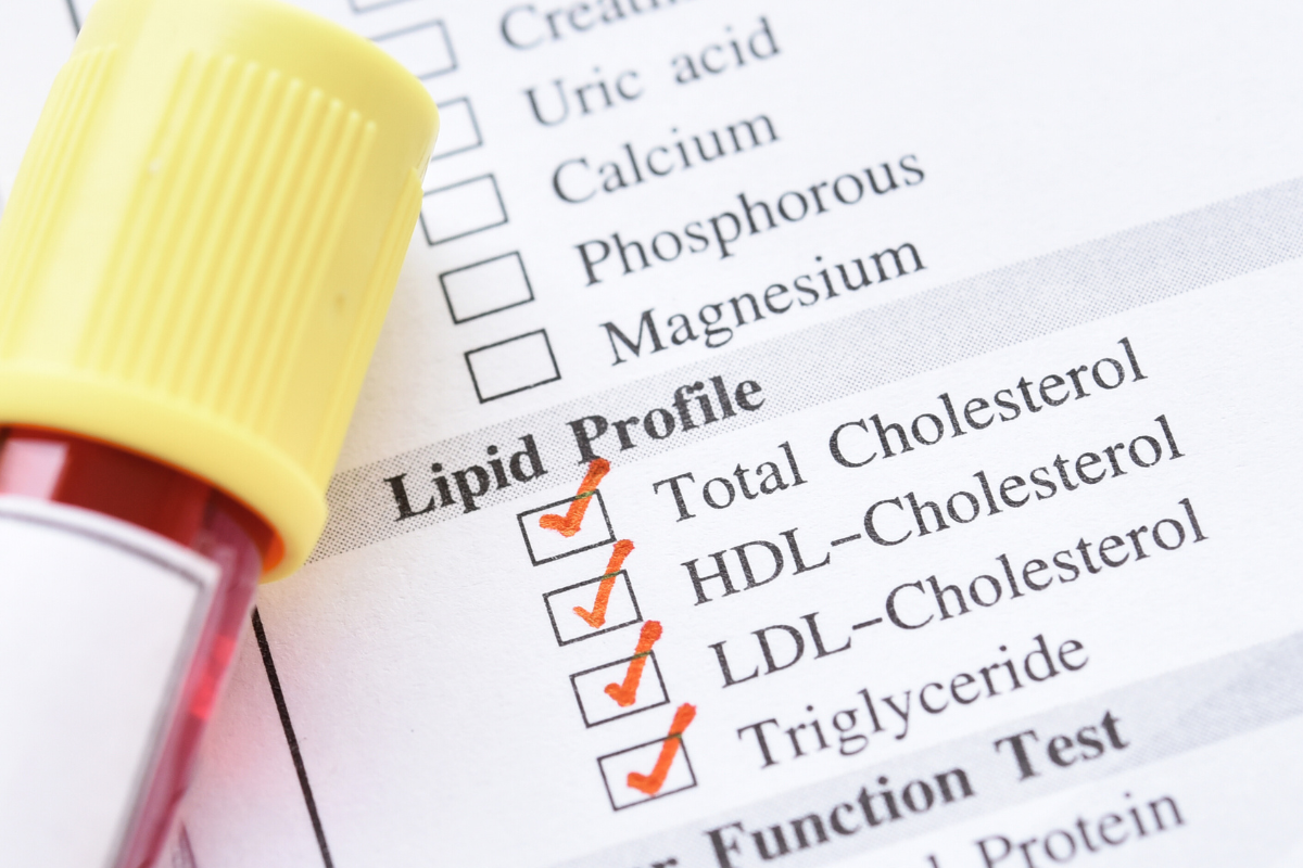 lipid profile screening for levels of different types of cholesterol